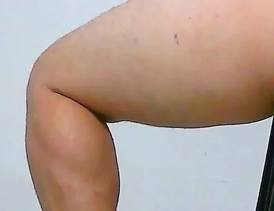 Oh, My Ass Hurts, Apply Ointment