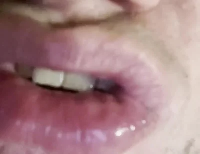 Mad for Tongue