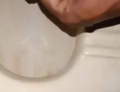 Urinating From the Penis
