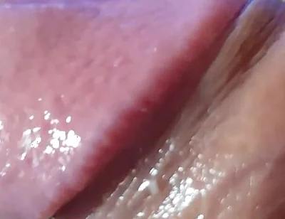 Strange Lumpy Cock with a Gigantic Head.
