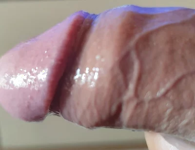 Strange Lumpy Cock with a Gigantic Head.