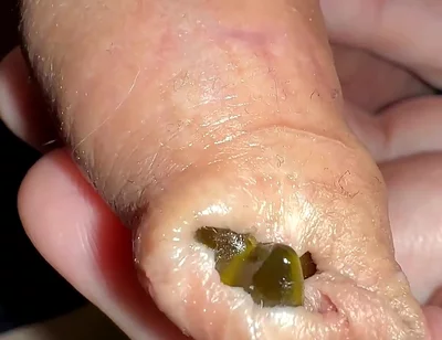 Juicy Small Cock Foreskin Games