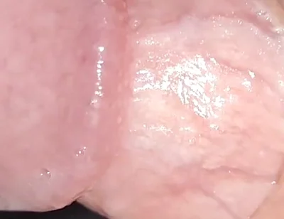 Incredible Cock, Unique of Slippery Phimosis by the Robust Body.