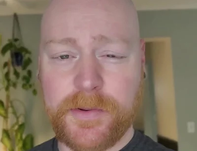 And as Always, It'll Grow Back