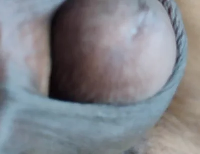 My Penis