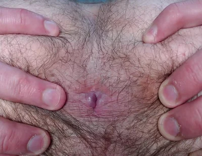 By Popular Demand, I Farted and Showed My Hairy Ass.