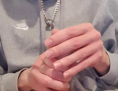 Skinny Lad Pulls Back Skin to Show Bellend