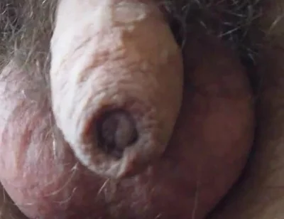 My Penis Walkabout