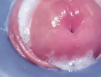 Penis Machine with a New Attachment