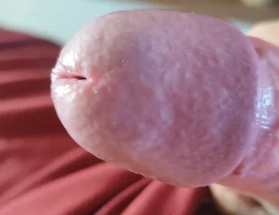 The Blossoming of Extensive Elastic Phimosis.
