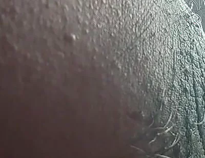 Armpit