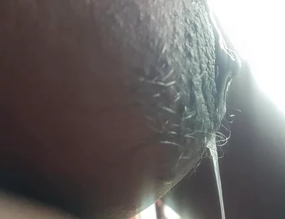 Armpit