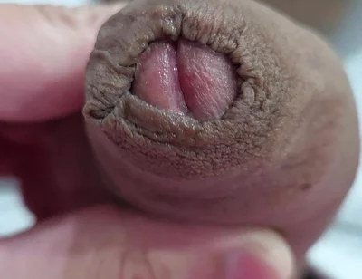 The Head of My Penis