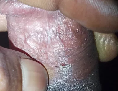 Now Videos