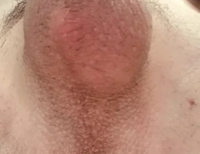 Do You Like Shaved or Hairy?