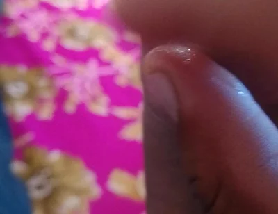 Look at My Penis