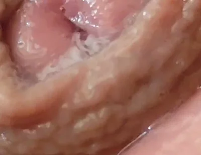 Juice From the Glans When Excited to the Extreme.