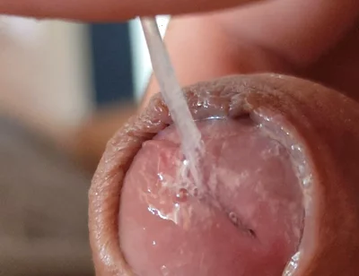 Juice From the Glans When Excited to the Extreme.