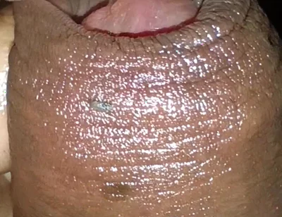 Close-up of Foreskin and Ejaculation in My Pants