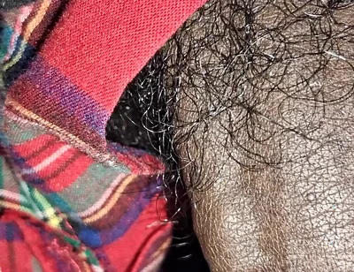 Close up on These Thick Veins