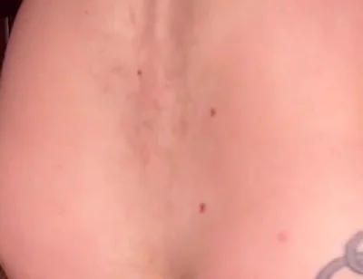 massage