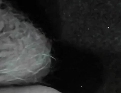 Arc of Sperm, Solo Amateur, Fountain