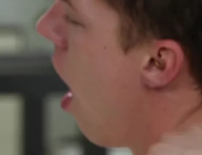 Exposed