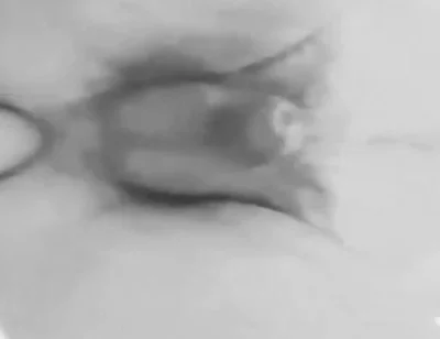Anal Plaisure