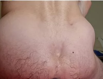 Extreme Anal Stretching With My Huge Blue Egg Plug