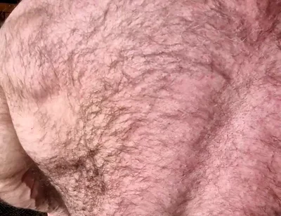 Hairy Muscle Back