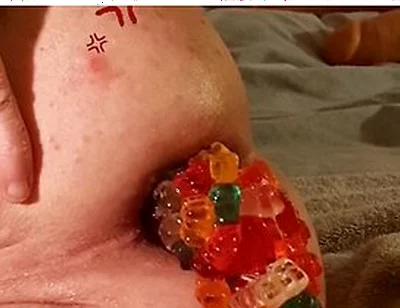 Big Load Of Gummy Bears Anal Stuffing And Expulsion Whit Prolapse