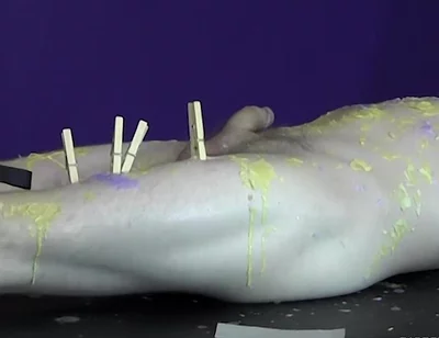 Pinching pegs leave welts
