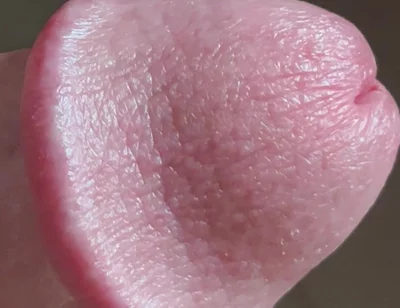 Closeup of Penis with One Vein