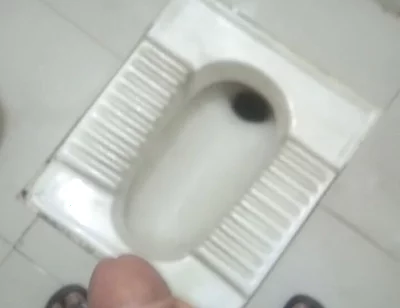 I Went to the Office Bathroom and Beat Myself up