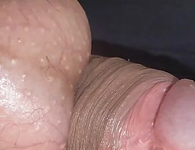 Amazing Upright Rough Venous Frenulum.