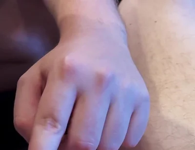 A Friend Plays with My Little Foreskin Cock