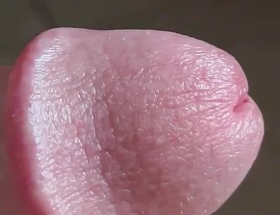Closeup of Penis with One Vein