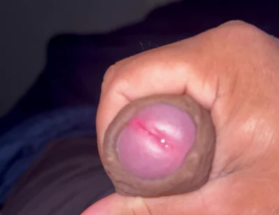 My Penis