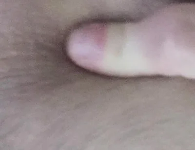 Dirty Anus