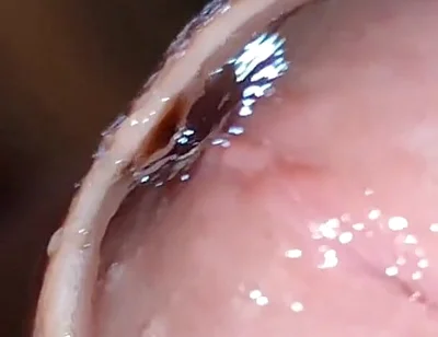 Glans Eye Watering After Intense Fucking.