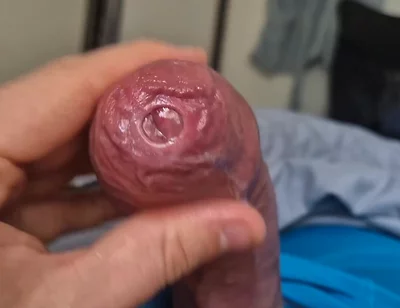 Phimosis Cock Precum Drip Close-up
