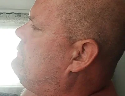 Renewed Destruction of the Bitch