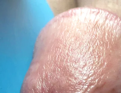 Hole Is Drilled Through