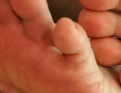 The Foot Master's Installation Protocol