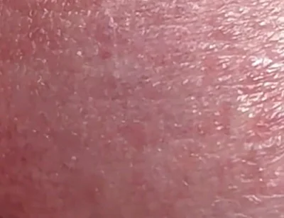Sperm Close-up Front