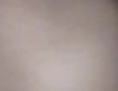Destroying the Asshole on the Dick