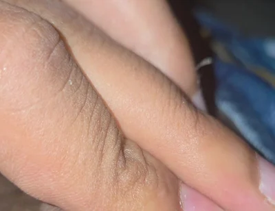 Closeup
