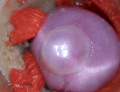 The Camera Inside the Deep Pussy Records a Huge Ejaculation with a Stuck Condom 4K