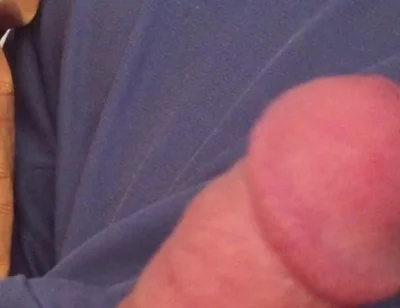 Surprise Dick
