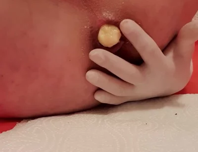 Timmyboy92's Ass Turned Banana Crusher